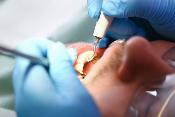 Reliable NH Emergency Dentist Solutions